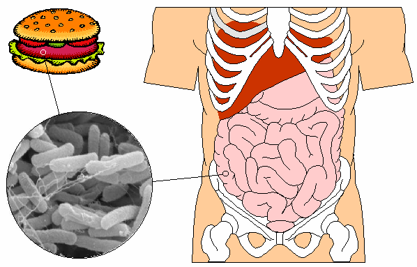E.coli is spread through contaminated beef E_ Coli